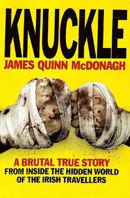 Knuckle 1