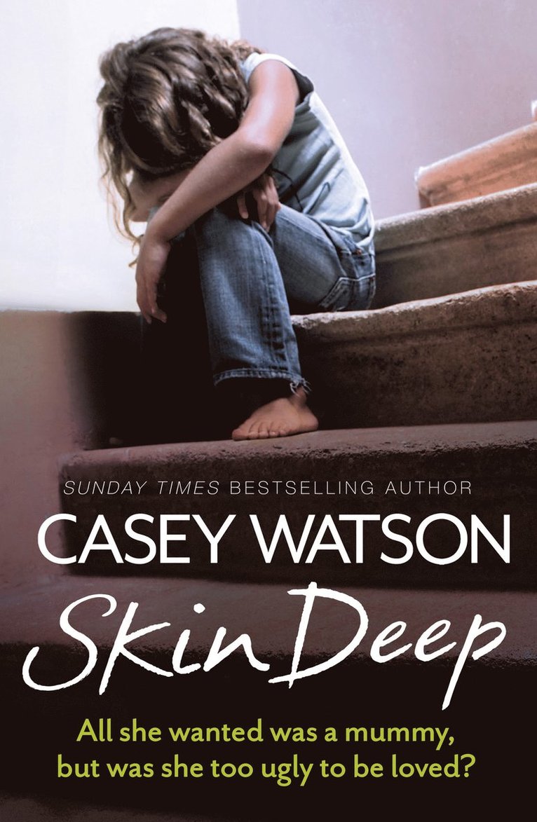 Casey Watson - Skin Deep, Häftad