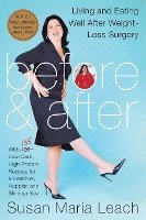Susan Maria Leach - Before & After, Revised Edition (Revised), Häftad