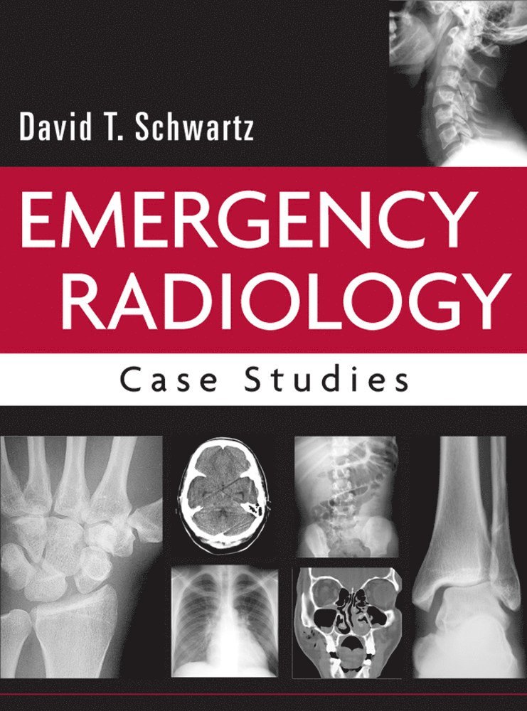 Emergency Radiology: Case Studies 1