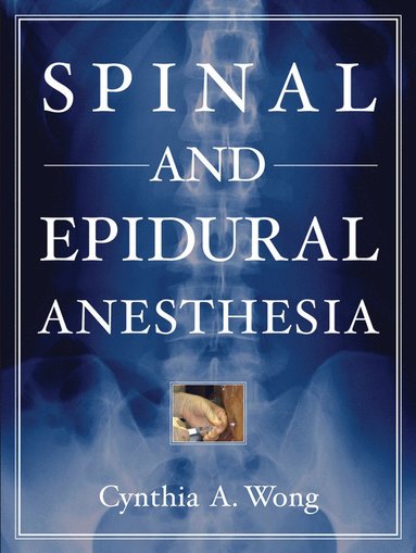 bokomslag Spinal and Epidural Anesthesia