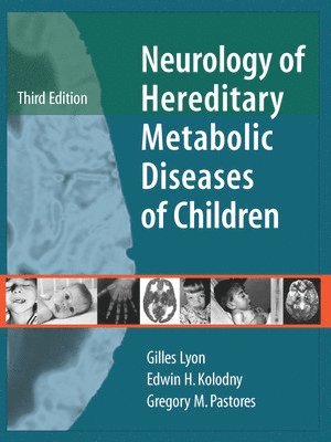 Neurology of Hereditary Metabolic Diseases of Children: Third Edition 1