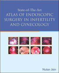 bokomslag State of the Art Atlas of Endoscopic Surgery in Infertility and Gynecology