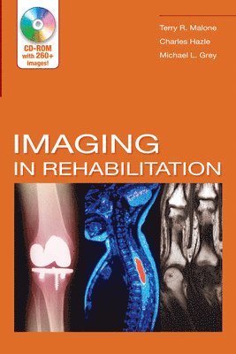 Terry R. Malone, Charles Hazle, Terry R Malone, Michael L Grey - Imaging in Rehabilitation [With CDROM], Häftad