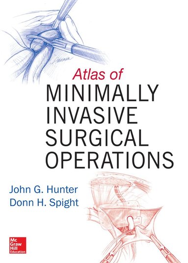 John Hunter, Donn Spight, Corinne Sandone, Jennifer Fairman - Atlas of Minimally Invasive Surgical Operations, Inbunden