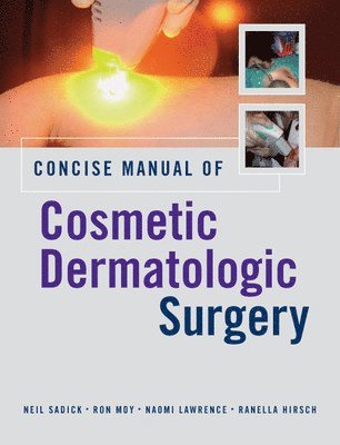 Concise Manual of Cosmetic Dermatologic Surgery 1