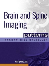 bokomslag Brain and Spine Imaging Patterns
