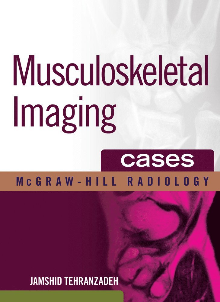Jamshid Tehranzadeh - Musculoskeletal Imaging Cases, Inbunden