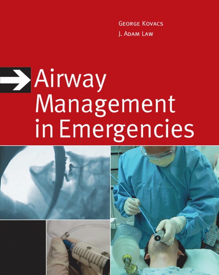 George Kovacs, J. Adam Law - Airway Management in Emergencies, Häftad