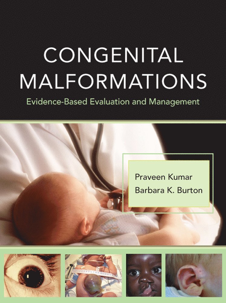 Congenital Malformations: Evidence-Based Evaluation and Management