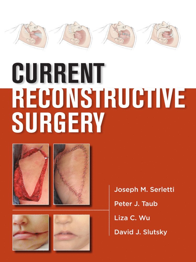 Joseph Serletti, Peter Taub, Liza Wu, David Slutsky, Joseph M. Serletti, Peter J. Taub, Joseph M Serletti, Peter J Taub - Current Reconstructive Surgery, Inbunden