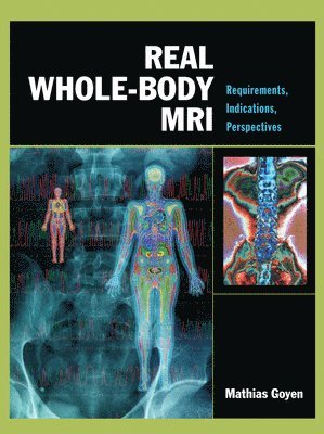 Mathias Goyen - Real Whole-Body MRI: Requirements, Indications, Perspectives, Inbunden
