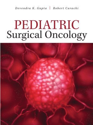 Devendra Gupta, Robert Carachi - Gupta, D: Pediatric Surgical Oncology, Inbunden