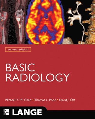 Basic Radiology, Second Edition 1