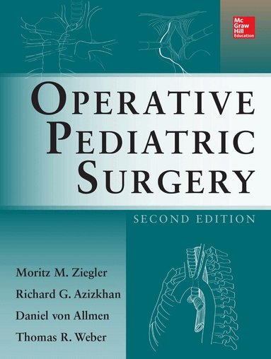 Moritz Ziegler, Richard Azizkhan, Daniel von Allmen, Thomas Weber - Operative Pediatric Surgery, Inbunden
