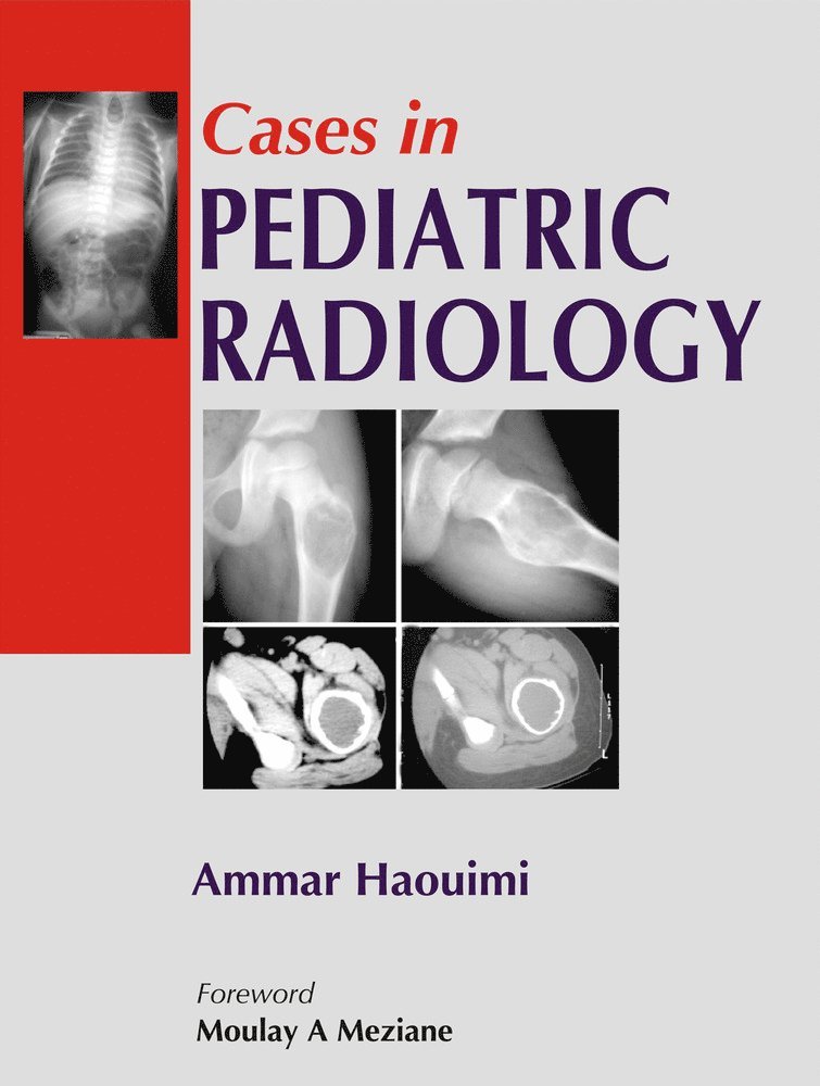 Ammar Haouimi - Cases in Pediatric Radiology, Häftad