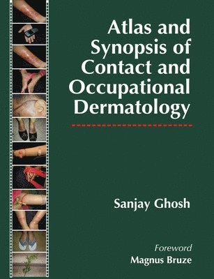 Sanjay Ghosh - Ghosh, S: Atlas and Synopsis of Contact and Occupational Der, Inbunden
