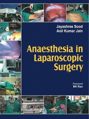 Sood, J: Anaesthesia in Laparoscopic Surgery