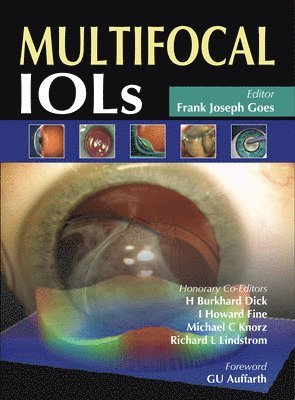 bokomslag Multifocal IOLs