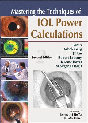 Ashok Garg, Jt Lin, Robert Latkany, Jerome Bovet, Wolfgang Haigis - Garg, A: Mastering the Techniques of Iol Power Calculations,, Inbunden