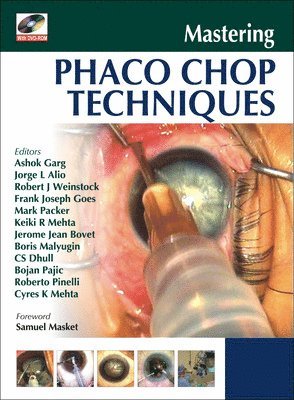 Ashok Garg - Mastering Phaco Chop Techniques, Inbunden
