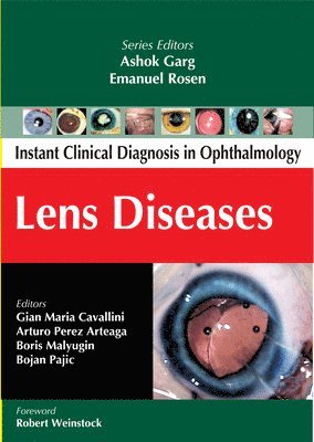 Lens Diseases 1