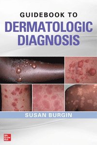 bokomslag Guidebook to Dermatologic Diagnosis