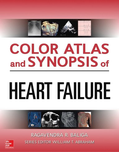 bokomslag Color Atlas and Synopsis of Heart Failure