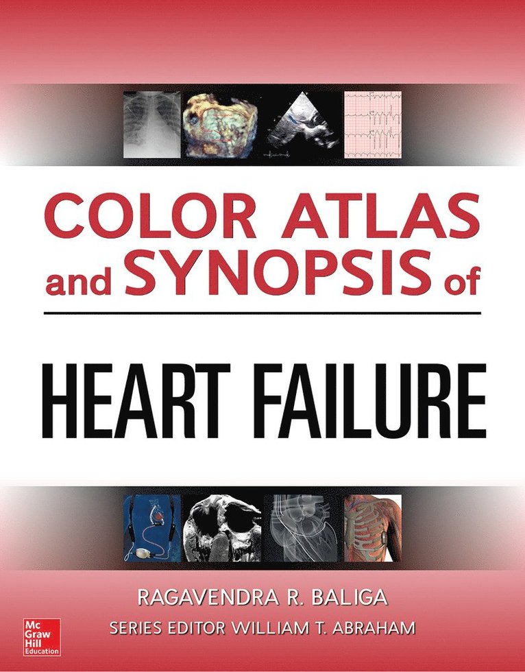 Color Atlas and Synopsis of Heart Failure