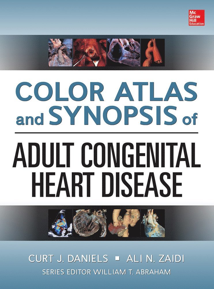 Curt Daniels, Ali Zaidi, Ali N. Zaidi, Ali N Zaidi - Color Atlas and Synopsis of Adult Congenital Heart Disease, Inbunden