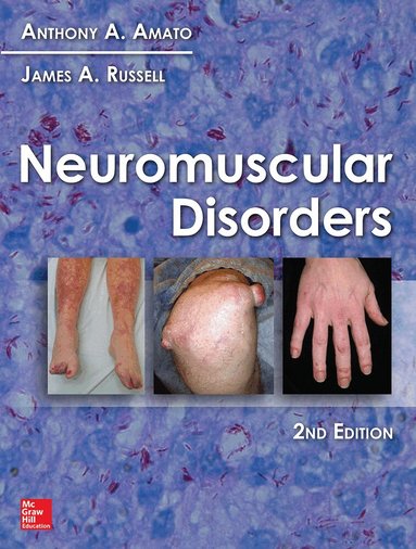 Anthony Amato, James Russell - Neuromuscular Disorders, Inbunden