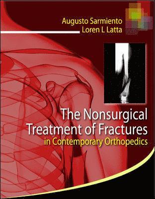 Nonsurgical Treatment of Fractures in Contemporary Orthopedics