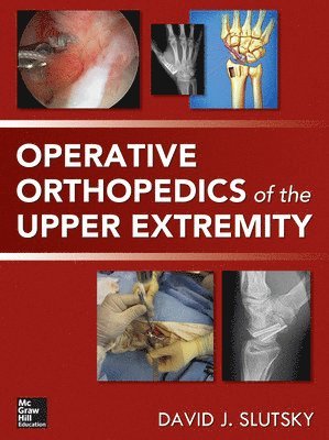 David Slutsky - Operative Orthopedics of the Upper Extremity, Inbunden