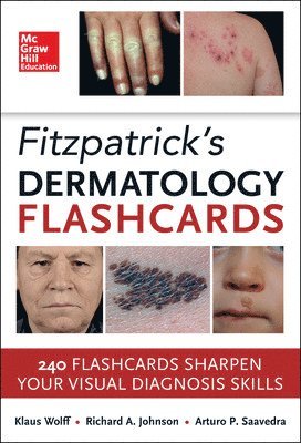 bokomslag Fitzpatricks Dermatology Flash Cards