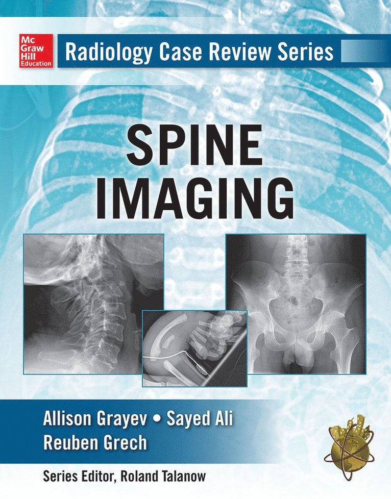 Allison Michele Grayev, Sayed Ali, Reuben Gretch - Radiology Case Review Series: Spine, Häftad