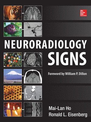 bokomslag Neuroradiology Signs