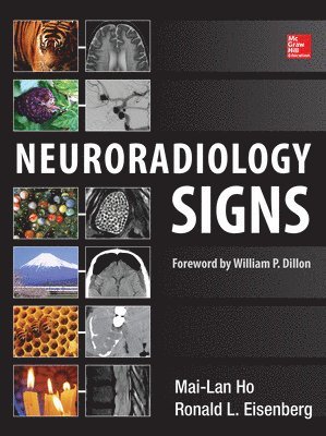 Neuroradiology Signs 1