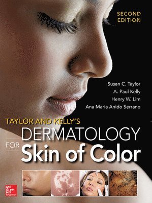 bokomslag Taylor and Kelly's Dermatology for Skin of Color 2/E