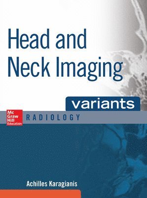 Head and Neck Imaging Variants 1