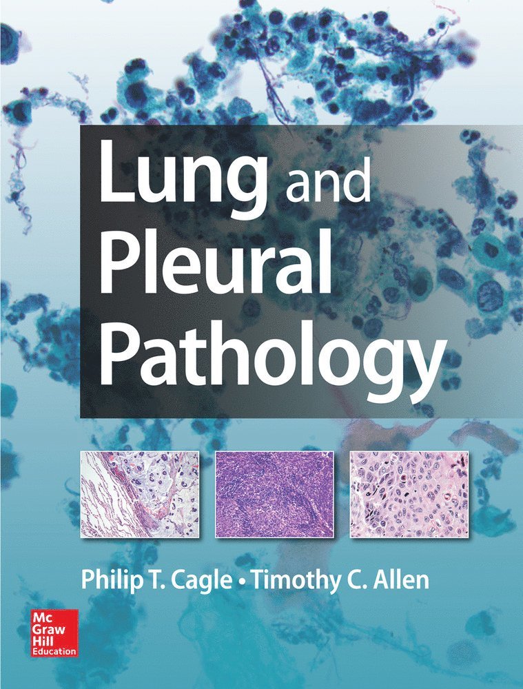 Philip Cagle, Timothy Allen, Timothy Craig Allen - Lung and Pleural Pathology, Inbunden
