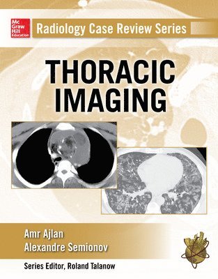 Amr Ajlan, Alexander Semionov, Amr M. Ajlan, Amr M Ajlan - Radiology Case Review Series: Thoracic Imaging, Häftad