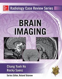 bokomslag Radiology Case Review Series: Brain Imaging