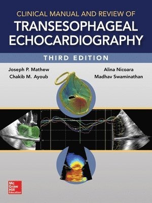 Joseph Mathew, Madhav Swaminathan, Chakib Ayoub - Clinical Manual and Review of Transesophageal Echocardiography, 3/e, Inbunden