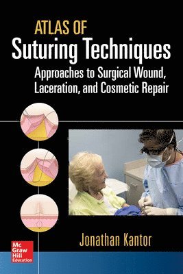 Kantor, J: Atlas of suturing techniques. Approaches to surgi