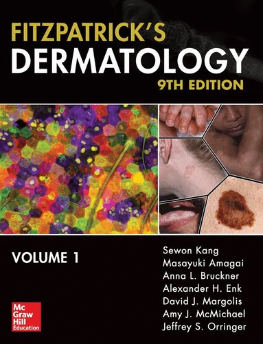 Sewon Kang - Fitzpatrick's Dermatology, Ninth Edition, 2-Volume Set, Inbunden