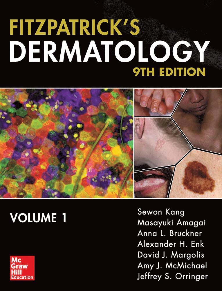 Sewon Kang - Fitzpatrick's Dermatology, Ninth Edition, 2-Volume Set, Inbunden