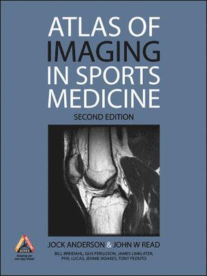Jock Anderson, John Read - Atlas of Imaging in Sports Medicine, Inbunden
