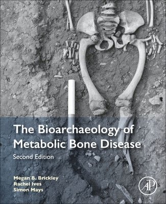 The Bioarchaeology of Metabolic Bone Disease 1