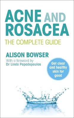 bokomslag Acne and Rosacea