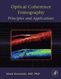 bokomslag Optical Coherence Tomography